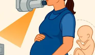 آیا رادیوگرافی دندانی در دوران بارداری بی خطر است؟