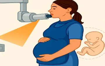 آیا رادیوگرافی دندانی در دوران بارداری بی خطر است؟