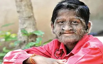 این زن در 75 سالگی سنگ زایید!