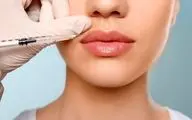 بعد از تزریق ژل و فیلر این علائم خطرناک است