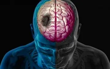 به این دلیل ساده خطر سکته در جوانان ۲ برابر می شود