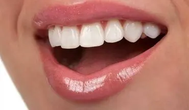 لبخندی درخشان و سفید با پیشگیری و راه های از بین بردن سیاهی دندان
