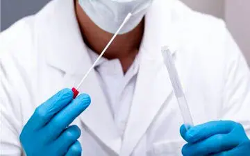 شکیبا: مراکز تست "کرونا" همچنان فعال است