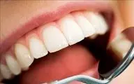 این ویتامین‌ها را فراموش نکنید، کلید سلامت دندان شما هستند
