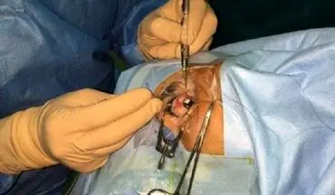 وزیر بهداشت،چشم ۱۱ بیمار نیازمند را جراحی کرد