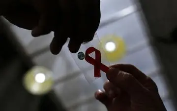سه راه برای انتقال HIV

