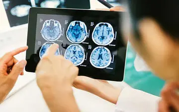  علائم لخته شدن خون در مغز