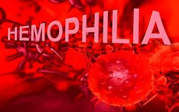 هموفیلی در مردان بیشتر است؟ یا زنان؟