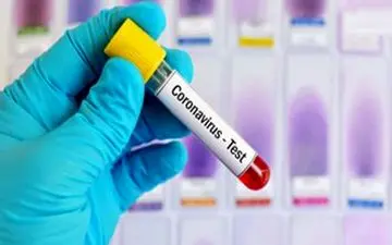 جدیدترین آمار قربانیان کرونا در جهان