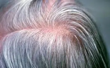 راهکاری طبیعی برای خلاصی از موی سفید