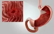 کدام یک از سبزیجات باعث زخم معده میشوند؟