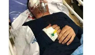 حادثه وحشتناک برای تکنسین هواپیما در اهواز / چشم او تخلیه شد + عکس