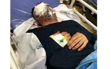 حادثه وحشتناک برای تکنسین هواپیما در اهواز / چشم او تخلیه شد + عکس