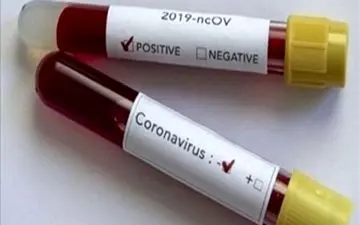 کیت‌های تشخیص ویروس کرونا به سنندج رسید