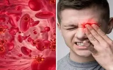 دلیل اصلی خستگی مفرط این مشکل است!