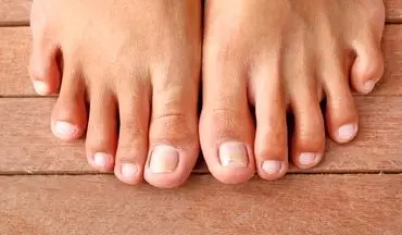 هر آنچه که ناخن‌های پا می‌توانند در مورد وضعیت سلامت بدن فاش کنند!