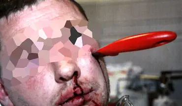 درگیری خونین در خیابان؛ چاقوی گنده لات تا دسته در سر حریفش فرو رفت!+عکس 