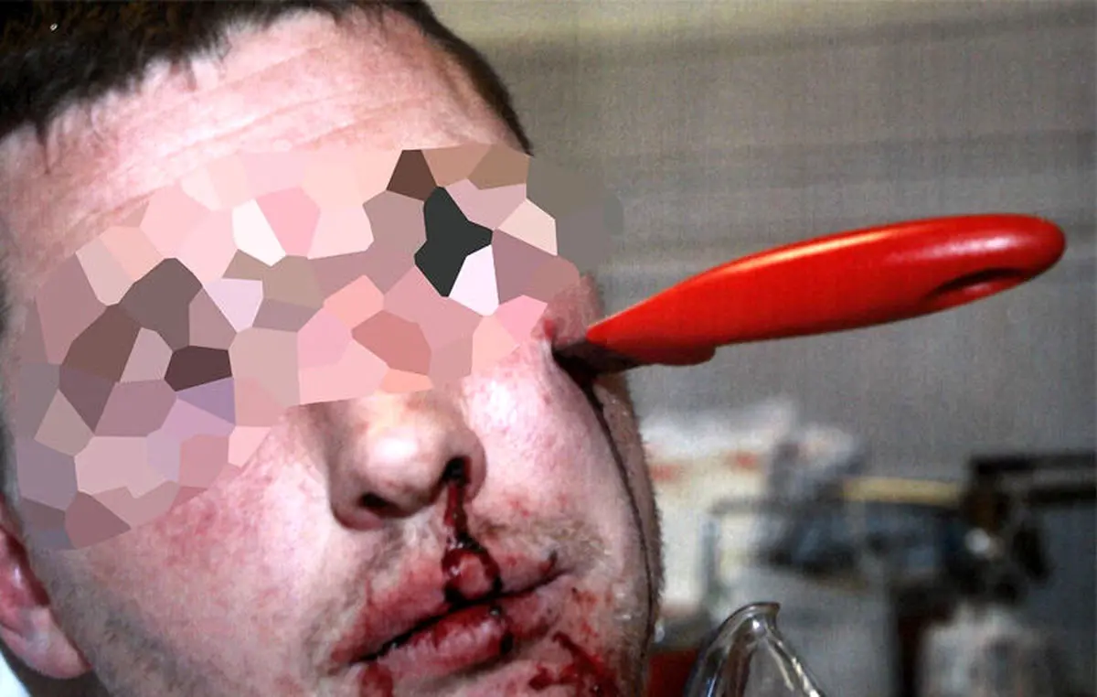 درگیری خونین در خیابان؛ چاقوی گنده لات تا دسته در سر حریفش فرو رفت!+عکس 