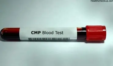 آزمایش CMP چیست ؟ | هرآنچه از آزمایش CMP باید بدانید