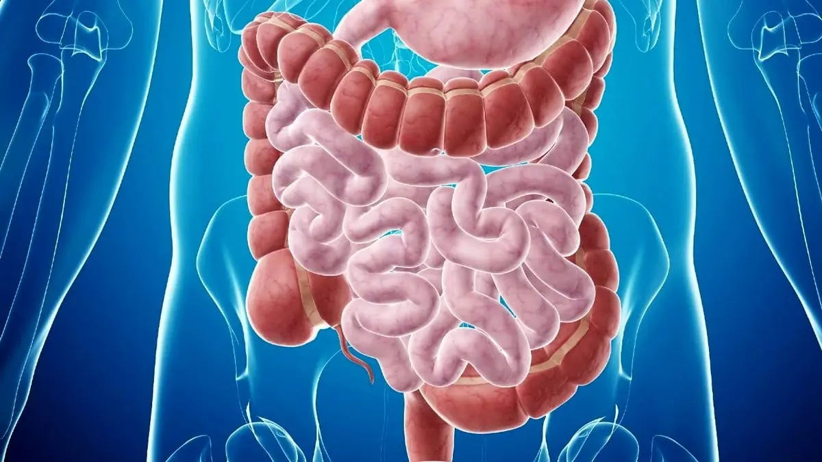 علائم اولیه سرطان روده بزرگ که باید بشناسید