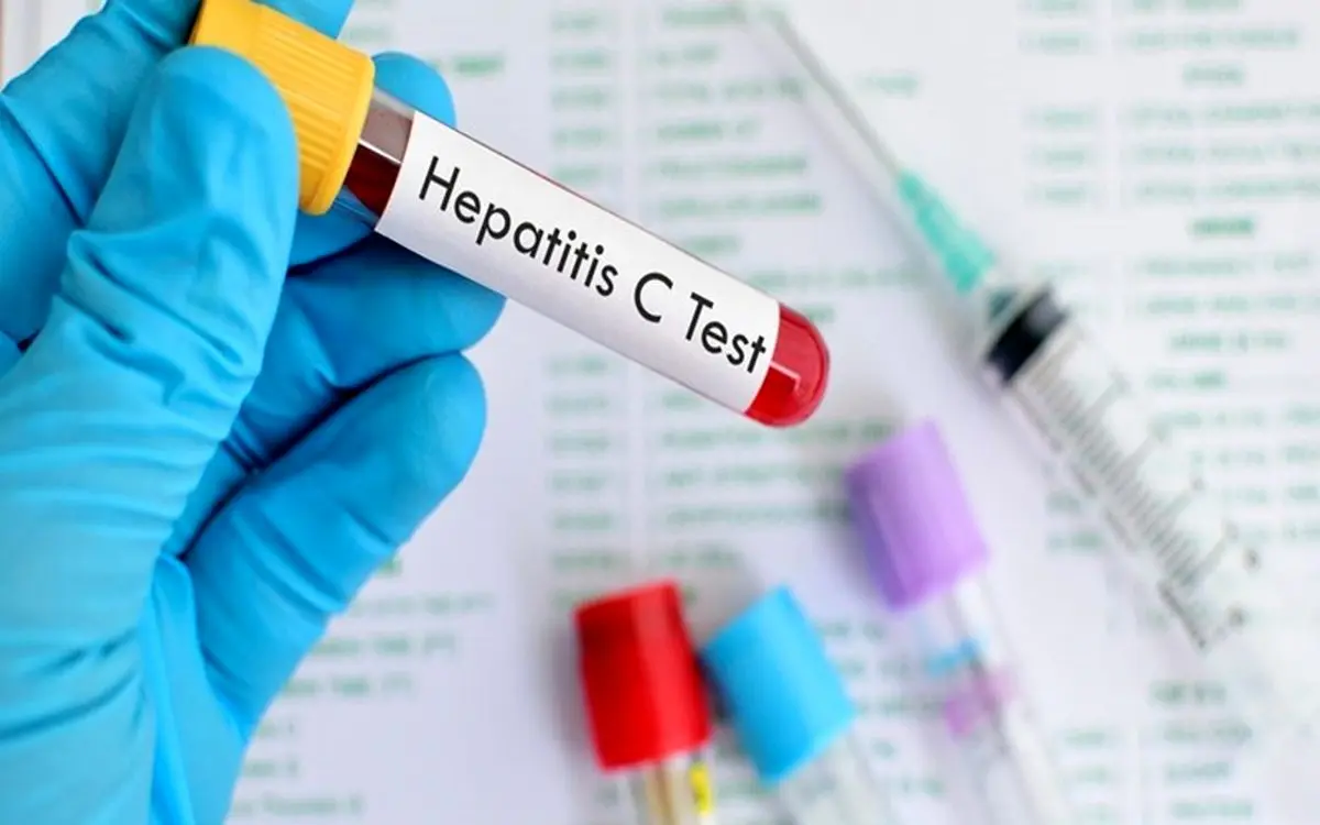 مهمترین عوامل انتقال بیماری هپاتیت C