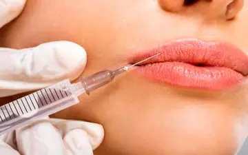 راز لب‌های طبیعی و جذاب: چقدر ژل تزریق کنیم که مصنوعی نشه؟