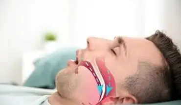 دلایل عرق سرد چیست؟| حتما به این موضوع توجه کنید!