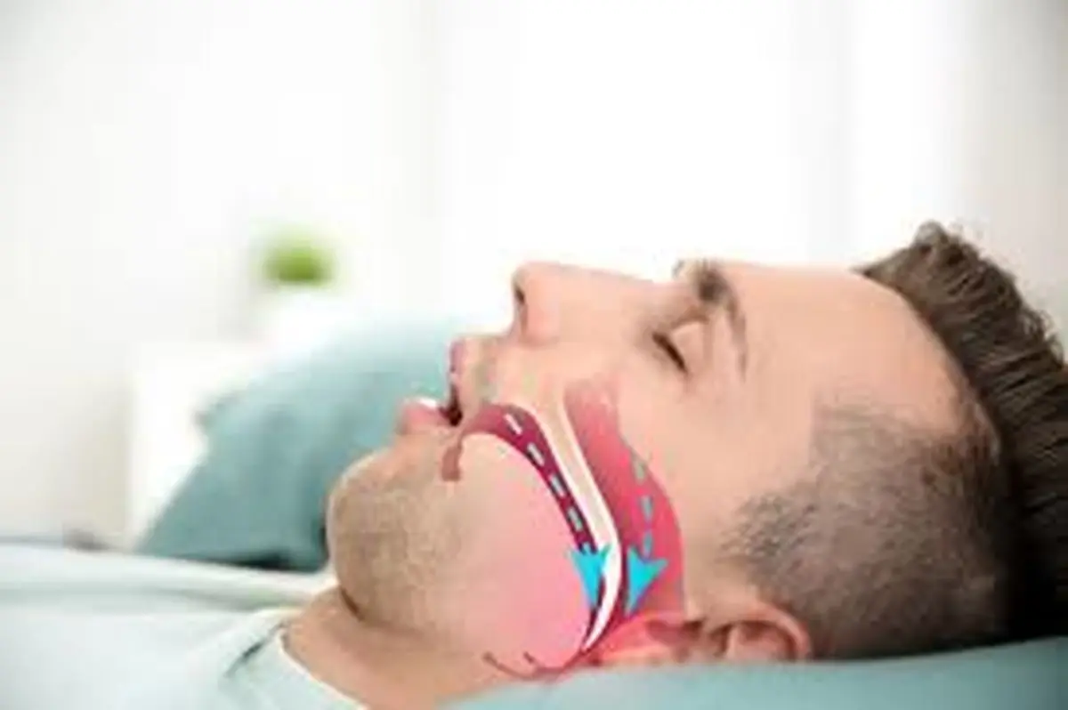 دلایل عرق سرد چیست؟| حتما به این موضوع توجه کنید!