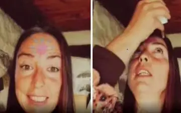 درمان عجیب ضعیفی چشم و آستیگماتیسم: استفاده از ادرار به عنوان قطره چشمی!