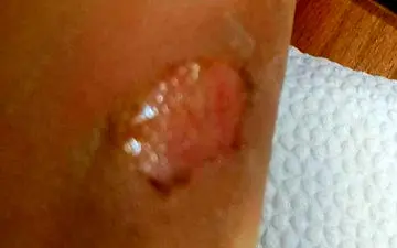 نامادری اراکی کودک 8 ساله را تا حد مرگ شکنجه داد 