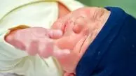اشتباه تغذیه ی مادر که زردی نوزاد را بدتر و بیشتر می کند