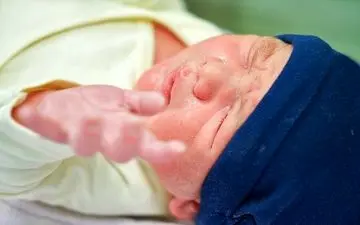 اشتباه تغذیه ی مادر که زردی نوزاد را بدتر و بیشتر می کند