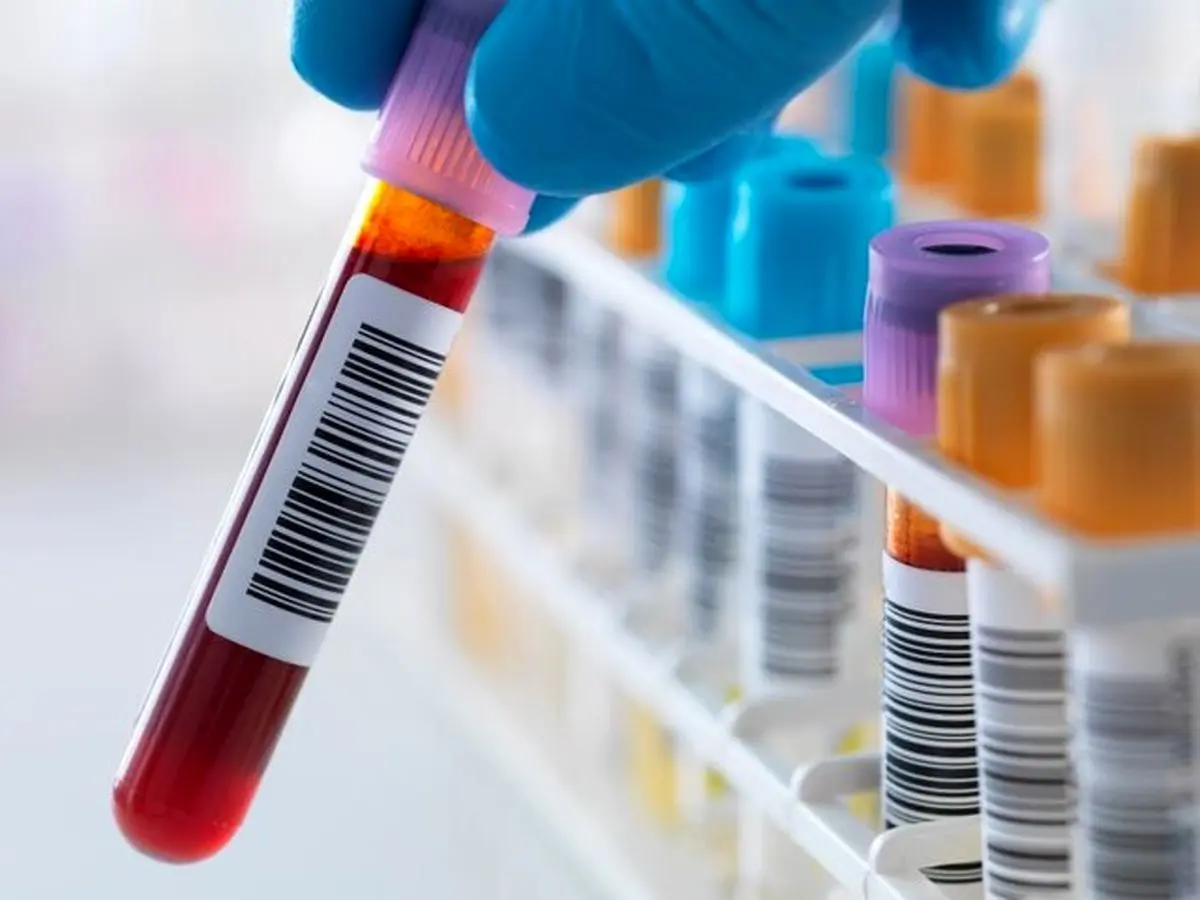 
یک آزمایش خون و تشخیص ده‌ها نوع سرطان