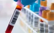 
یک آزمایش خون و تشخیص ده‌ها نوع سرطان