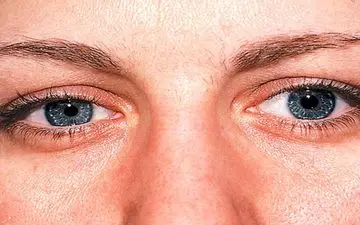 علائمی ترسناک که خبر از بیماری چشم می‌دهند