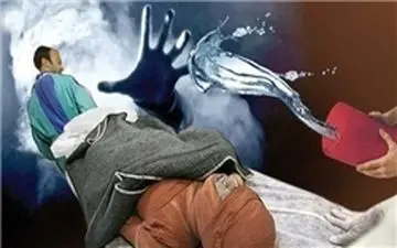  اسیدپاشی به صورت همسر فقط بخاطر یک تصور اشتباه