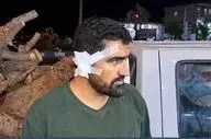 حمله وحشیانه سودجویان به مامور منابع طبیعی باشت؛ گوش مامور پاره شد!
