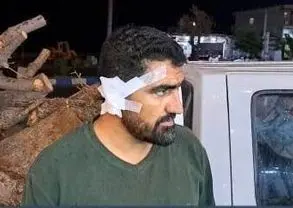 حمله وحشیانه سودجویان به مامور منابع طبیعی باشت؛ گوش مامور پاره شد!
