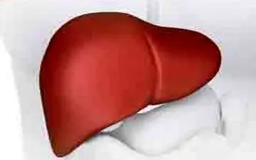 درمان جدید و قطعی کبد چرب