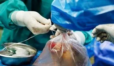 اعضای بدن بانوی ۵۲ ساله کنگانی اهدا شد