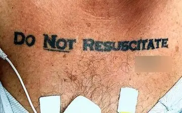 خالکوبی عجیب بیمار، مانع نجاتش ازمرگ شد + عکس