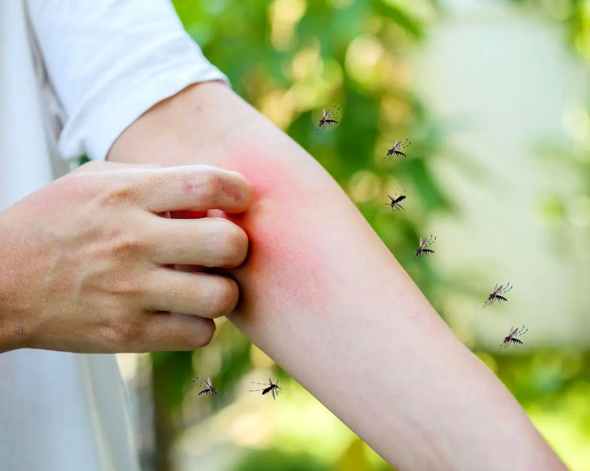 پشهها بر چه اساسی بعضیها را بیشتر نیش میزنند؟