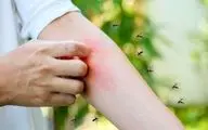 پشه‌ها بر چه اساسی بعضی‌ها را بیشتر نیش می‌زنند؟