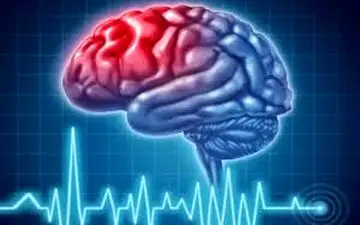 پیشگیری از سکته مغزیبا این مواد غذایی!