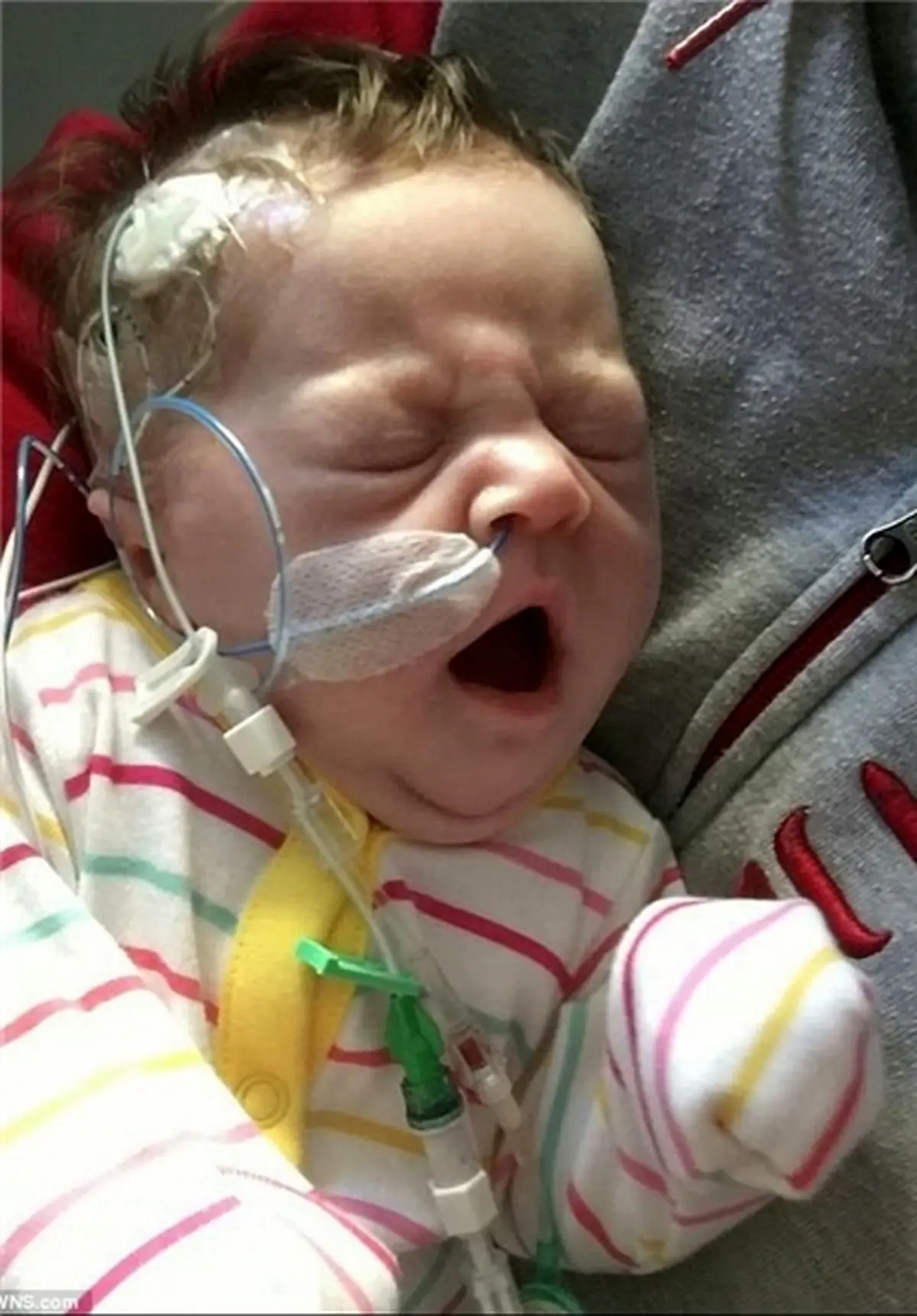 همه با دیدن این نوزاد تازه متولد شده شوکه شدند+عکس