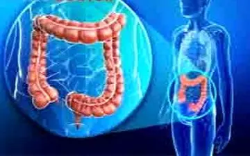 خون در مدفوع | وجود خون در مدفوع خطرناک است؟