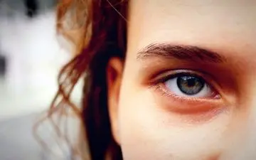 این علامت ها در چشم هایتان نشان می دهد بیماری کلیه دارید