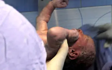  تولد نوزاد از جنین دبل فریز پس از 12 سال در اصفهان