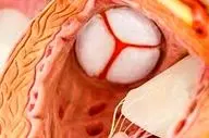 این علائم به شما می گویند به بیماری‌های دریچه‌ای قلب مبتلا هستید!