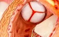 این علائم به شما می گویند به بیماری‌های دریچه‌ای قلب مبتلا هستید!